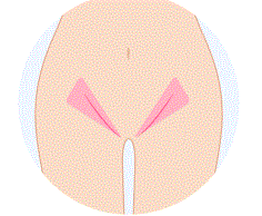 V