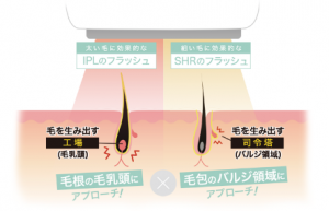 脱毛マシン