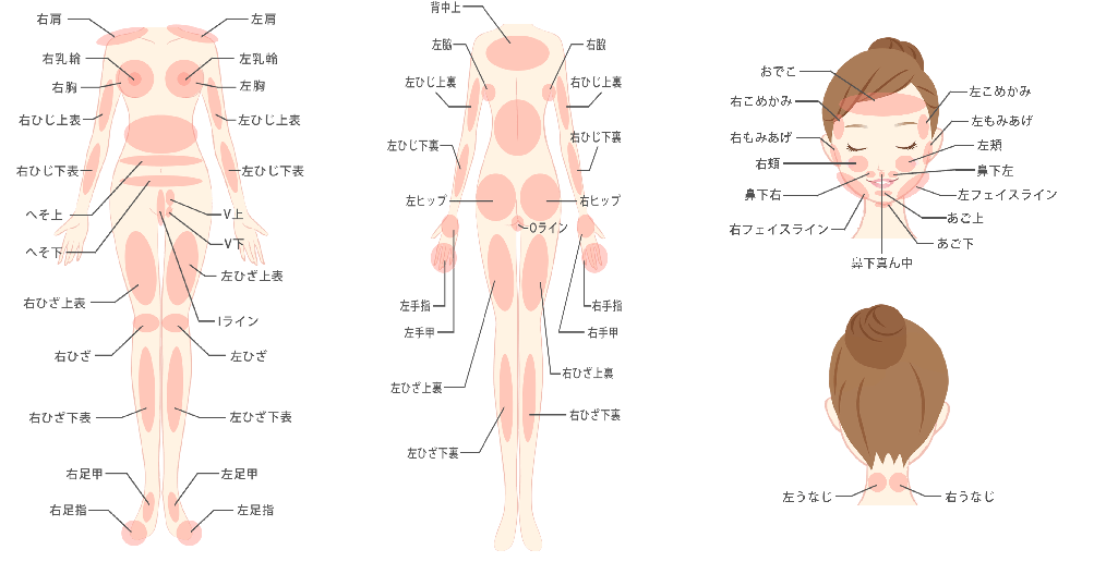 pic_hairremoval_nt_04
